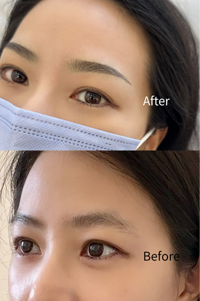 before (1)